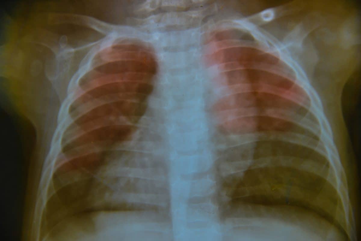 Płuca dziecka - jak się rozwijają?