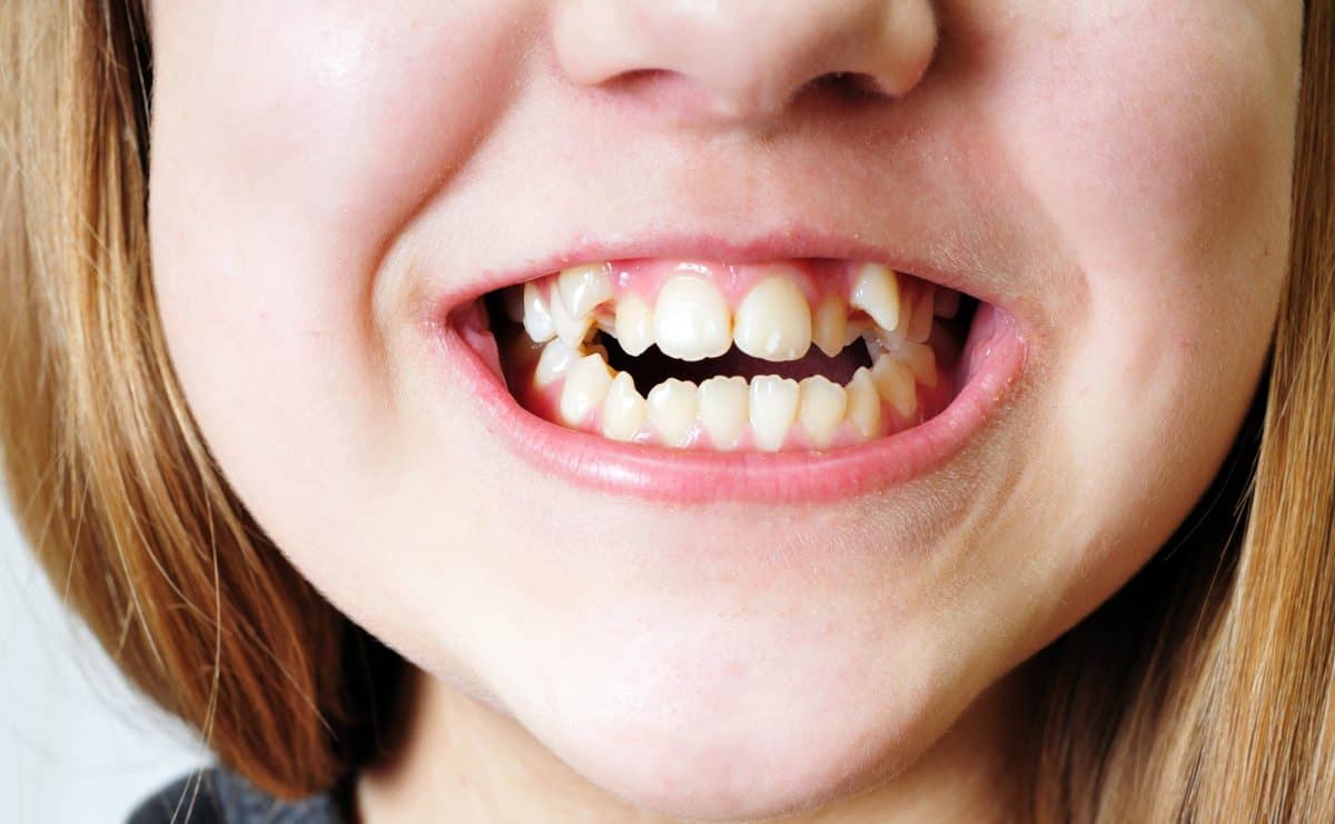 Profilaktyka ortodontyczna