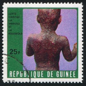GUINEA CIRCA 1970: stamp printed by Guinea, shows Sick child, circa 1970